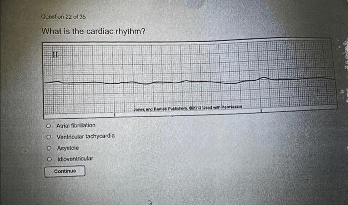 Aacn identifying dysrhythmias exam answers