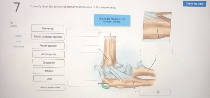 Correctly label the following anatomical features of the elbow joint.