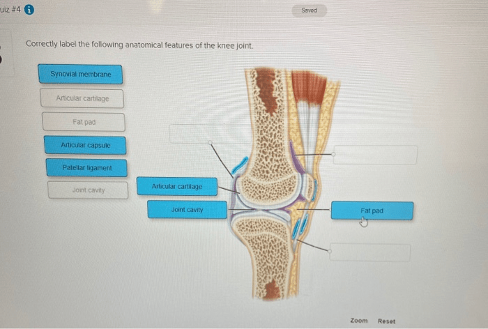 Label synovial following correctly anatomical uiz